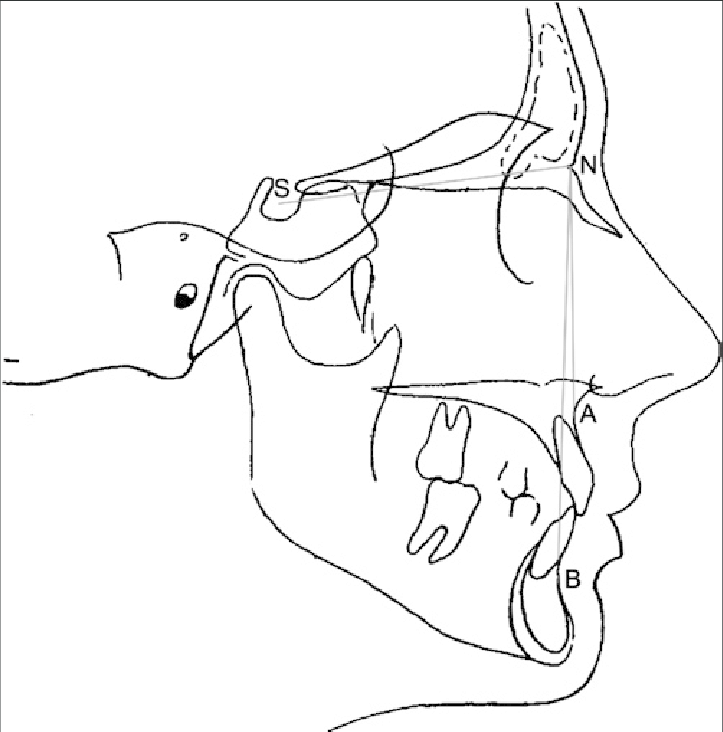 Steiner cephalometric analysis maxilla and mandible evaluations