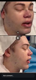 IMG 3428