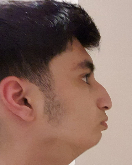 1783266636744