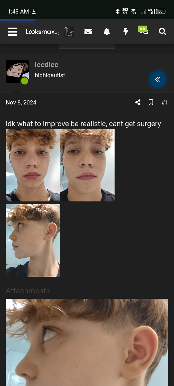 1000012122