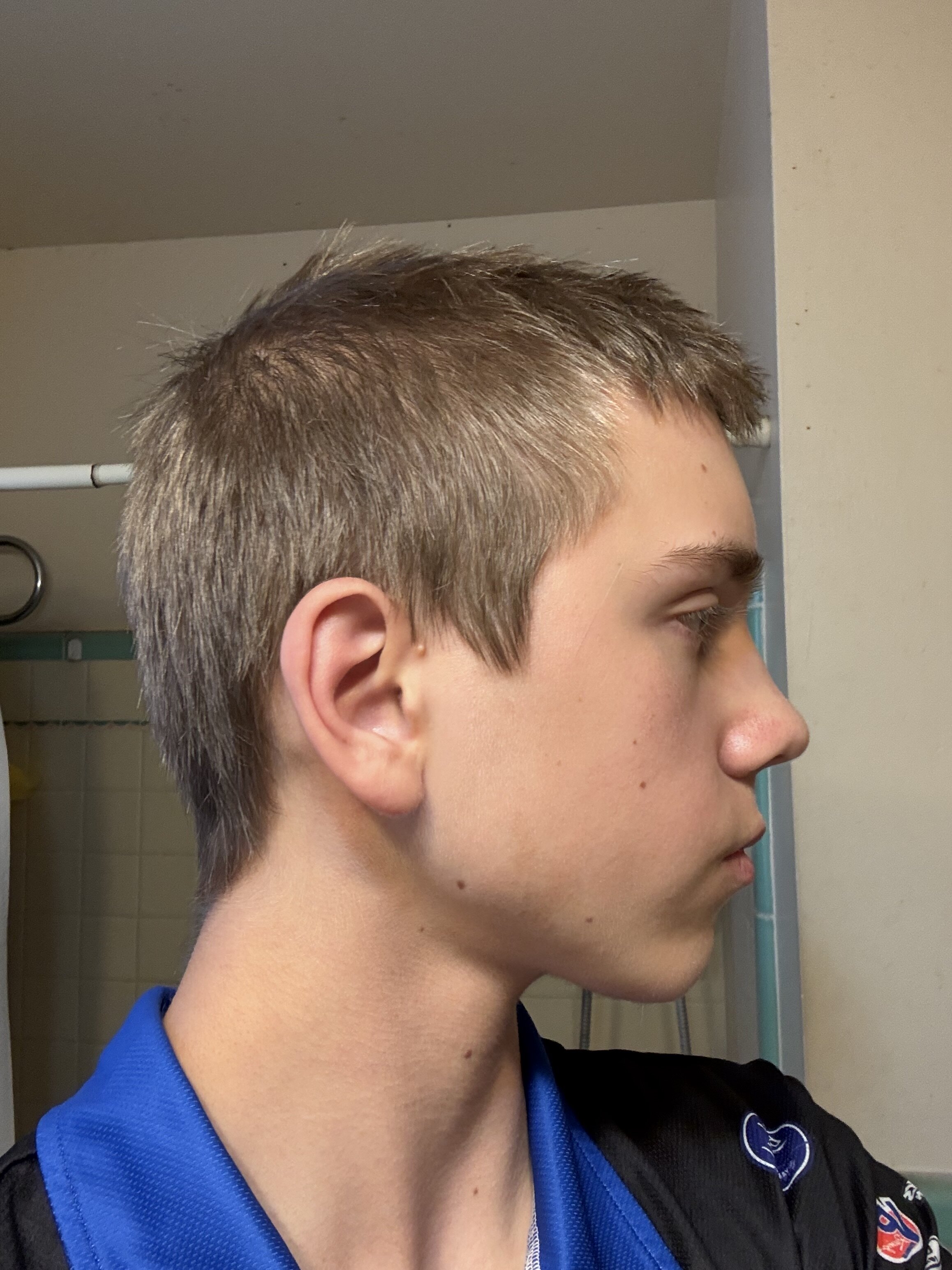 IMG 1698