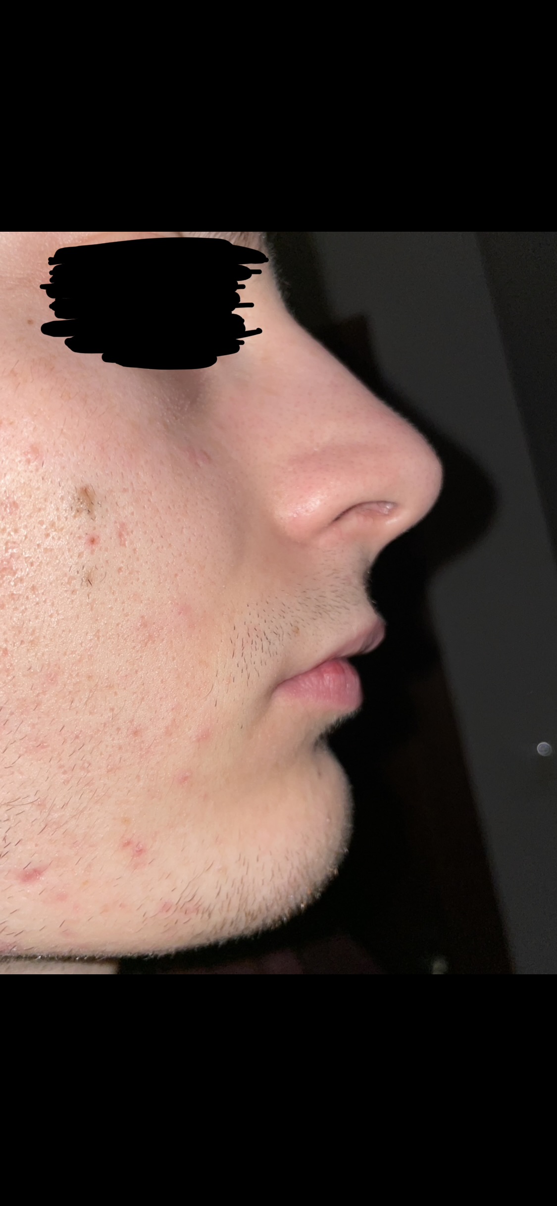 IMG 2560