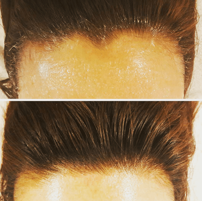 scalp-microblading.png.webp