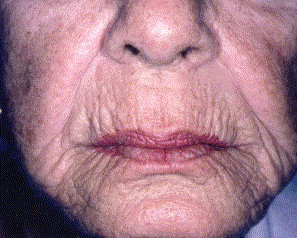 IMG 0141