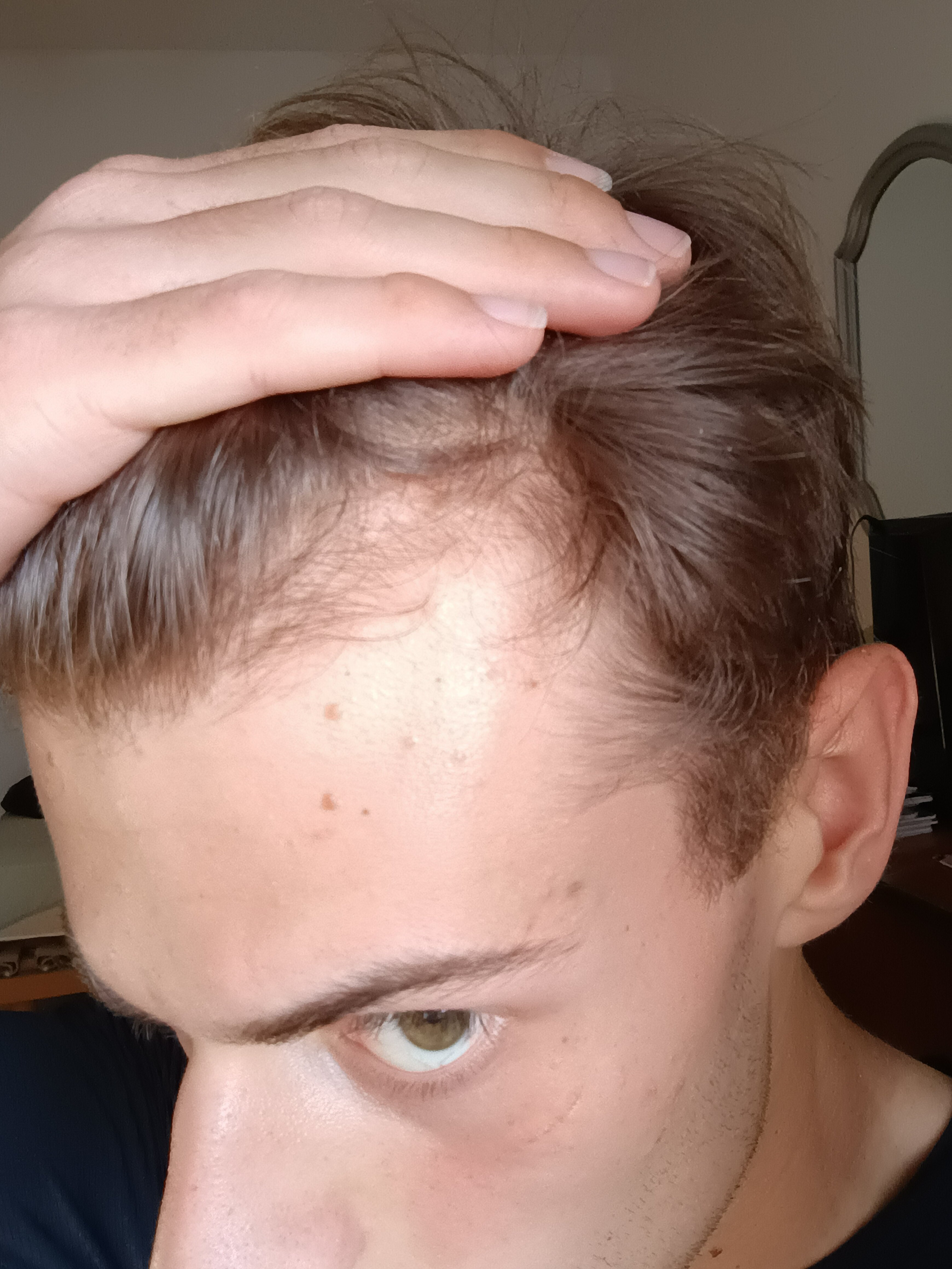 1000029461