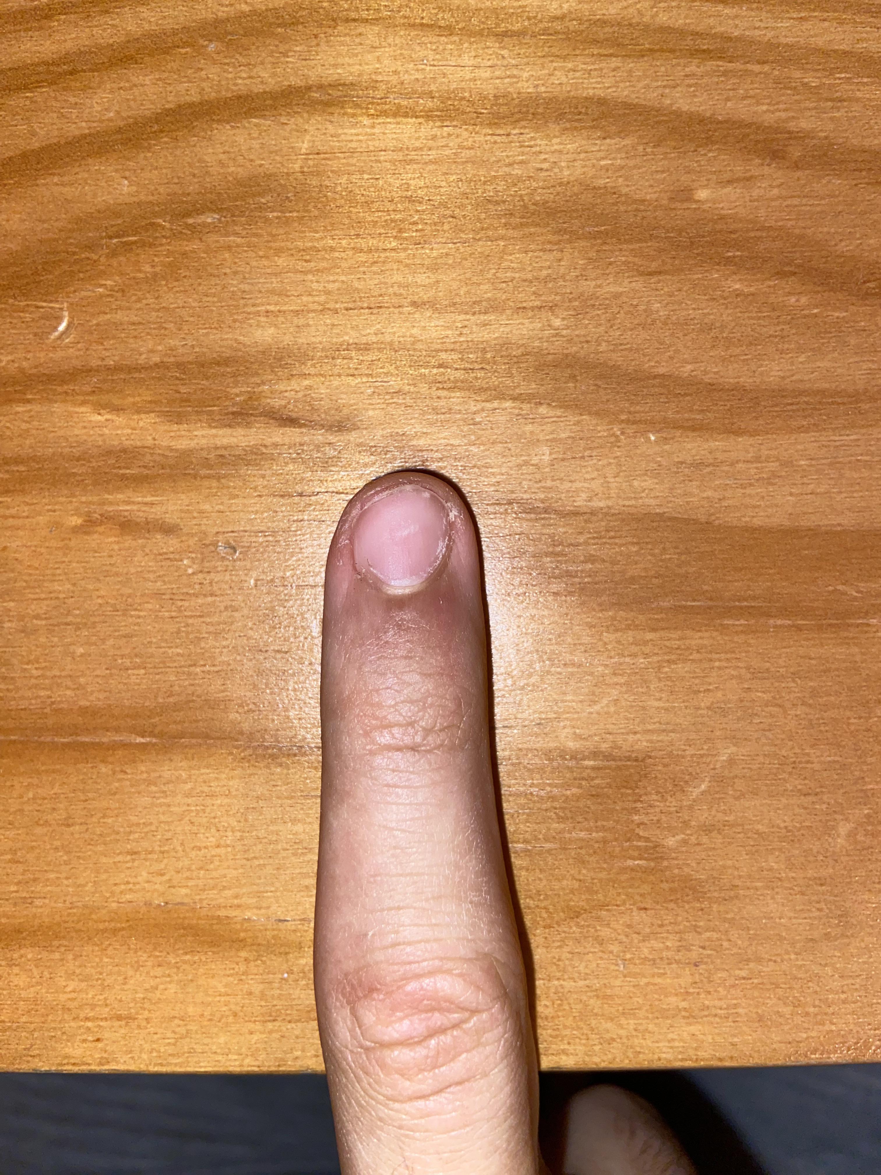 IMG 8227