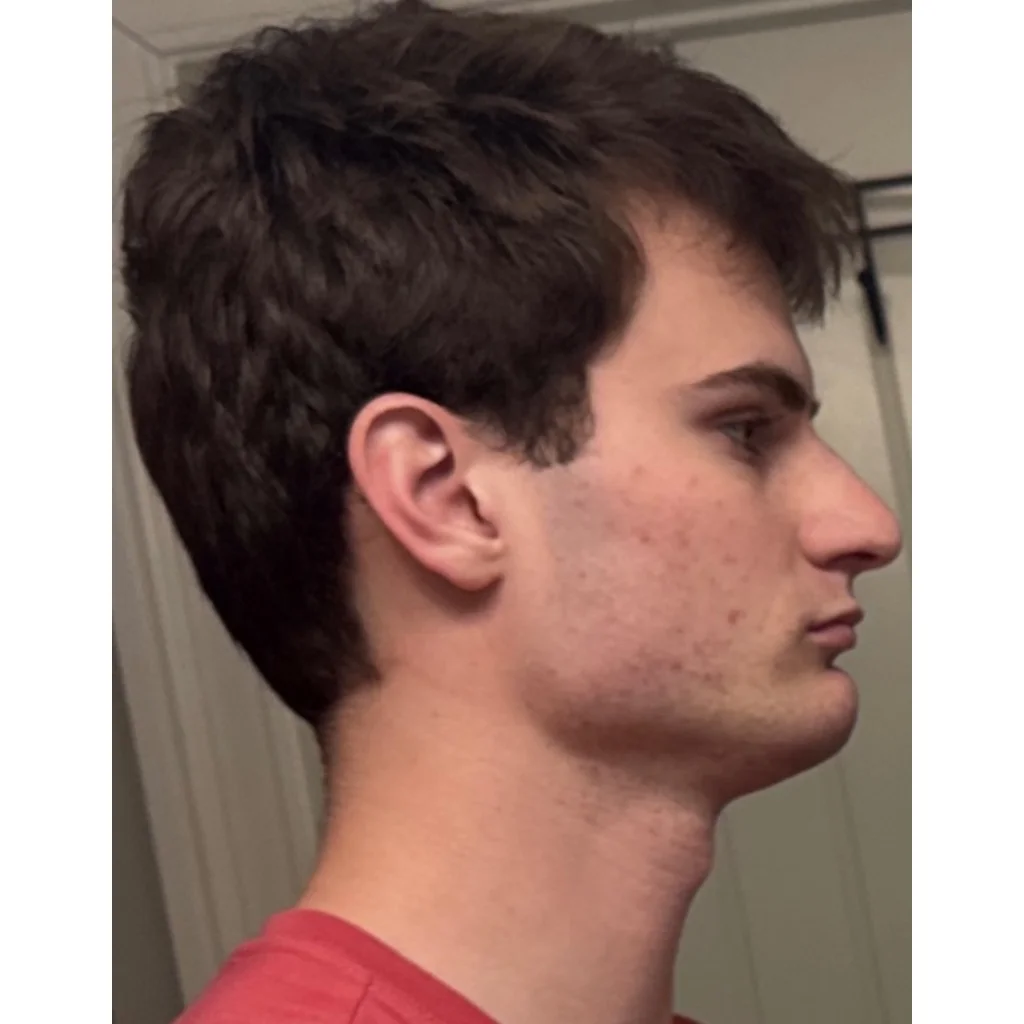 IMG 0431