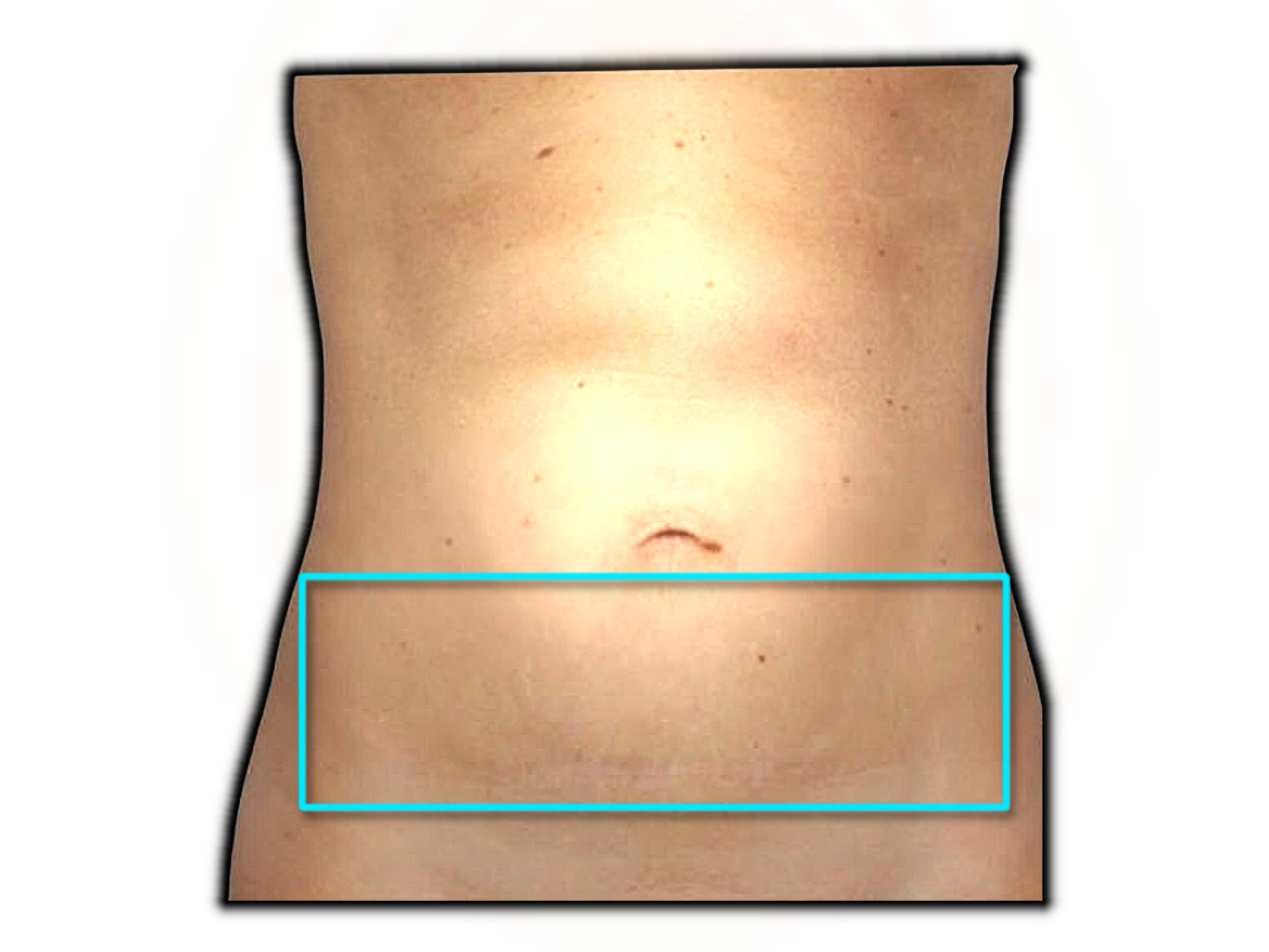 Injection site example