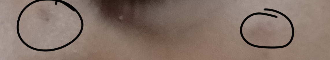 1000121157
