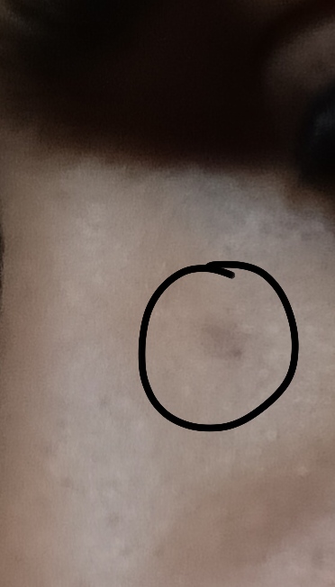 1000121160
