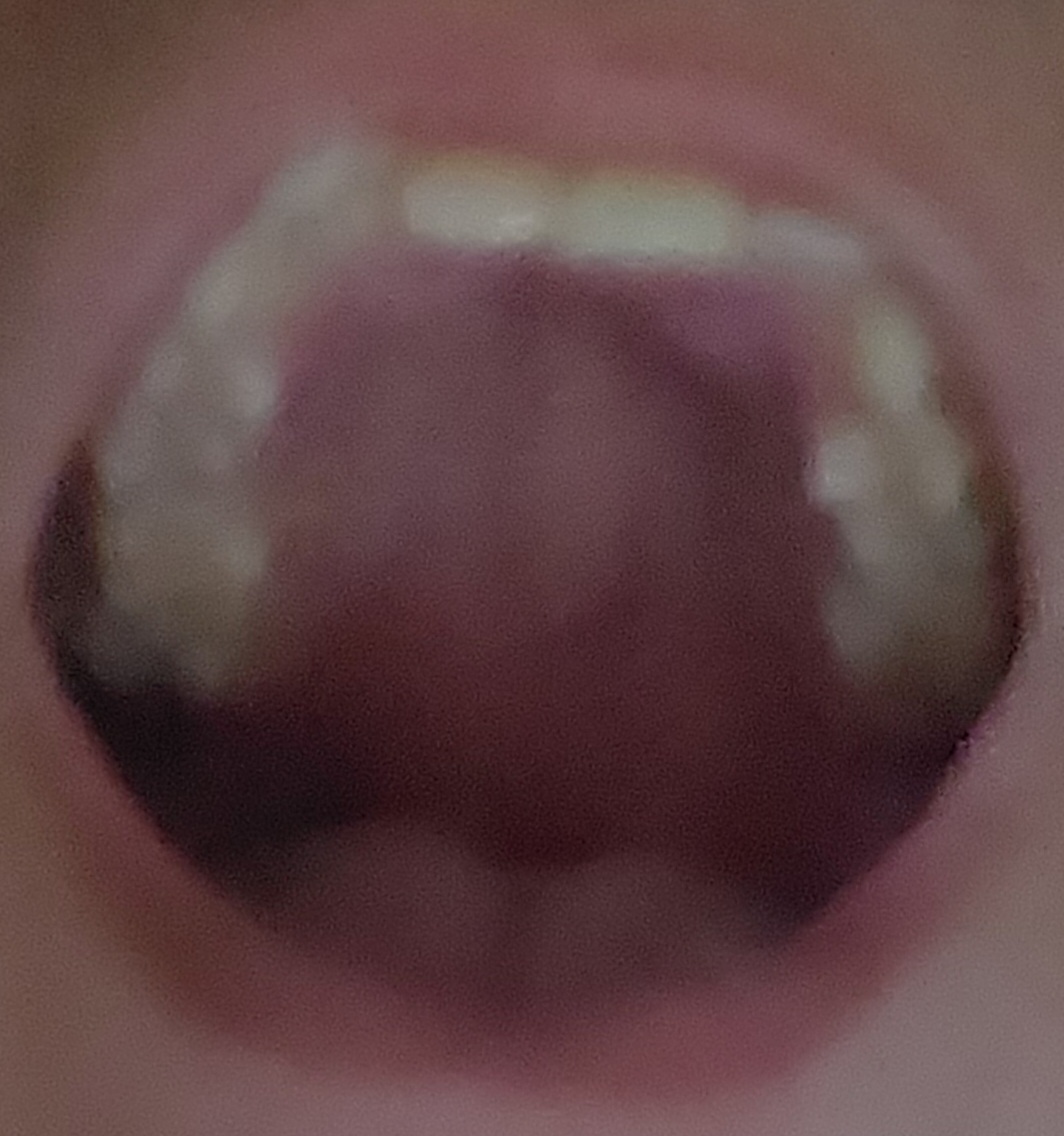 20260707 163735