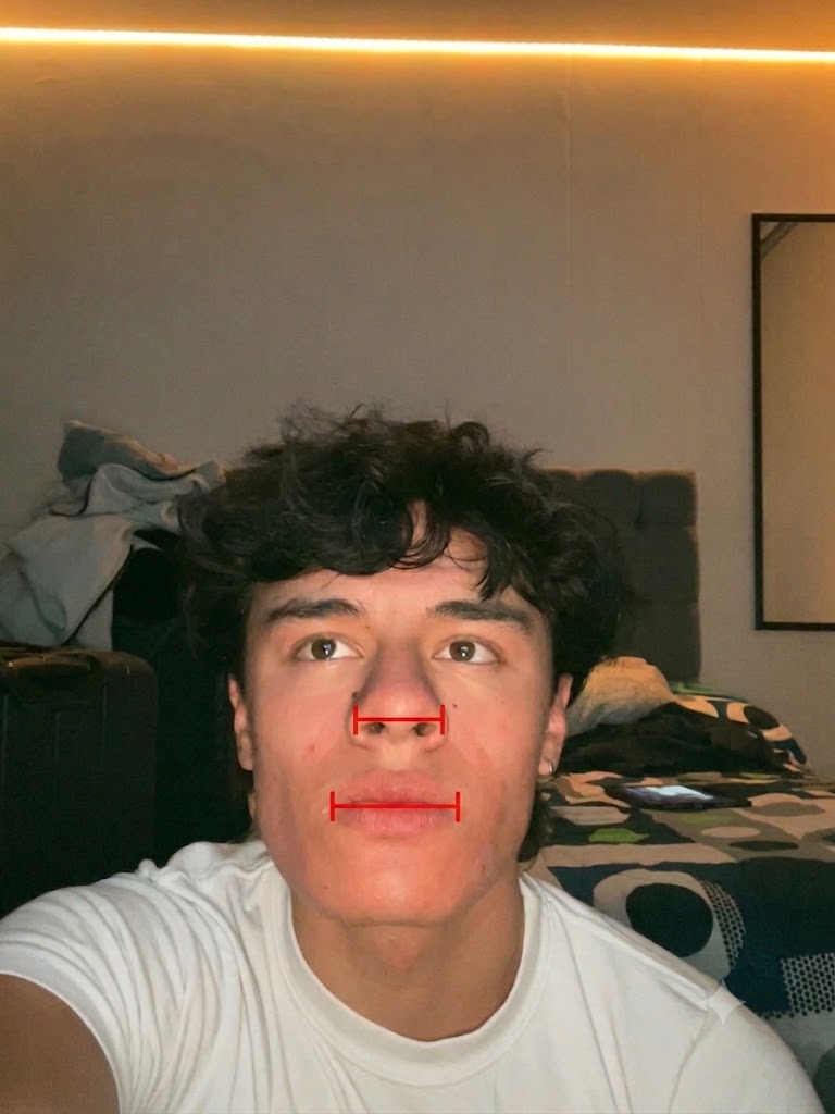 IMG 2762