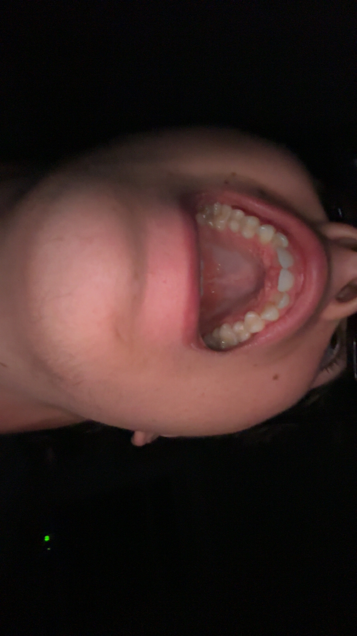 IMG 2638