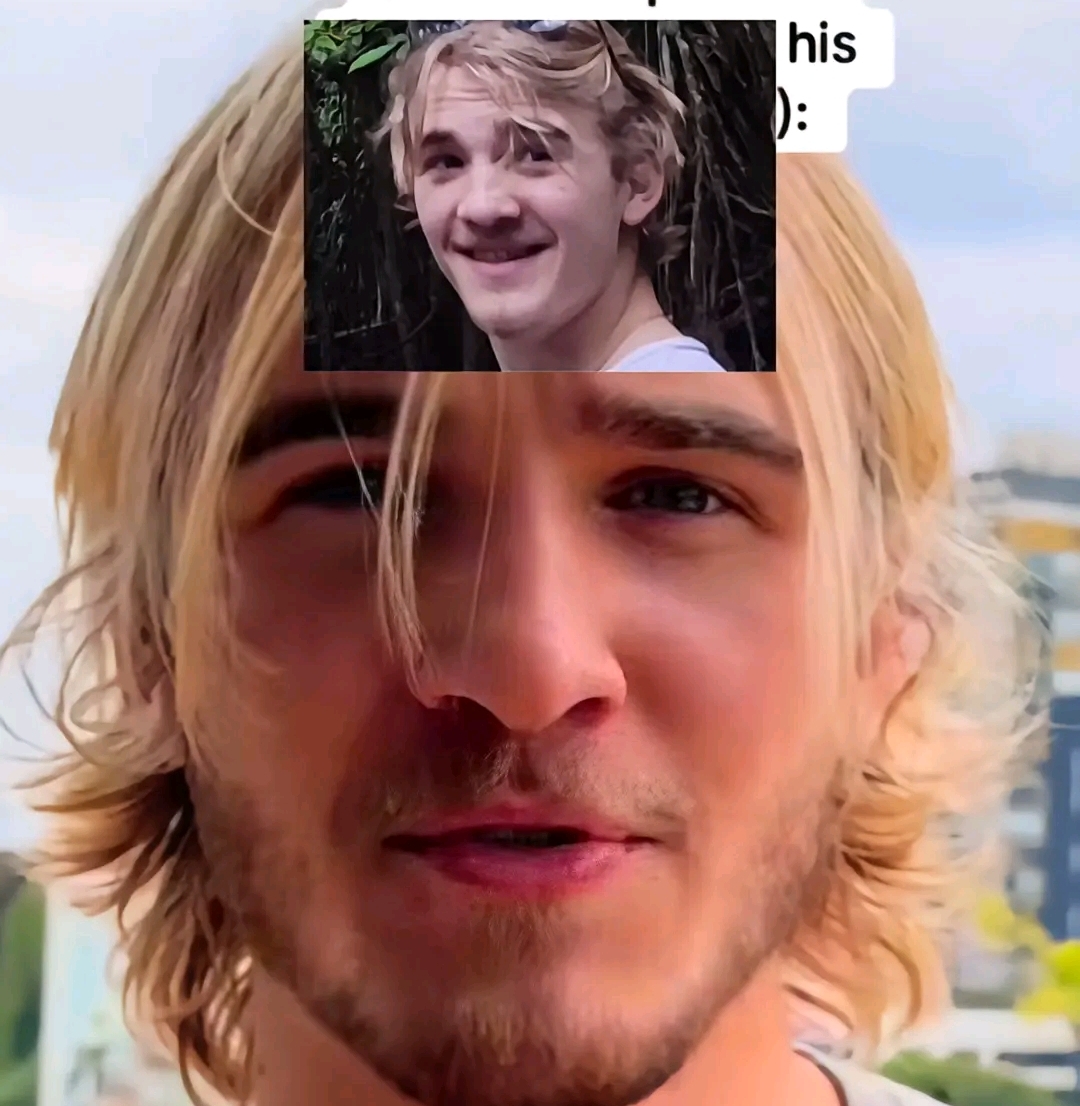 1000063332