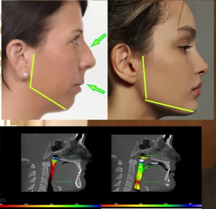 Biology dictates beauty standards