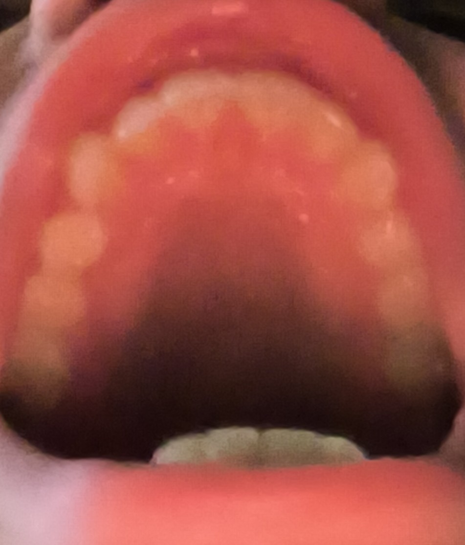 1000029261
