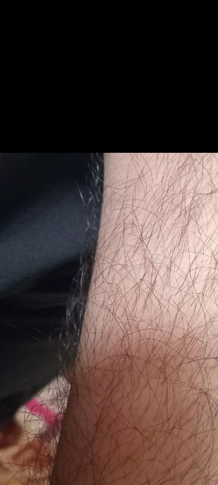 1000029044