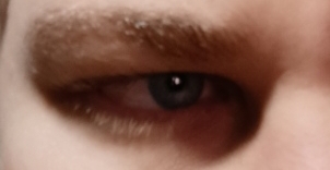 1000035685