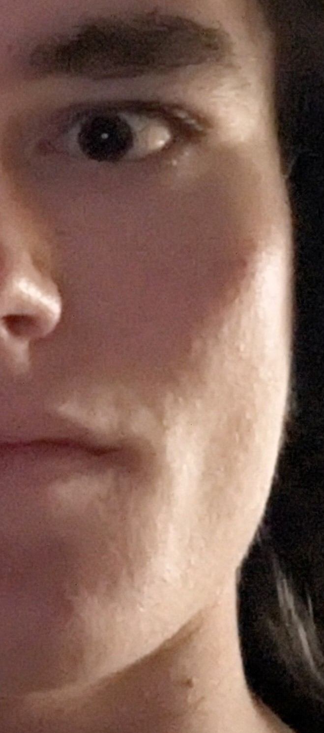 17215