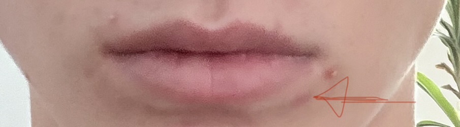 IMG 0552