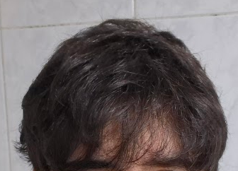 1783980226977