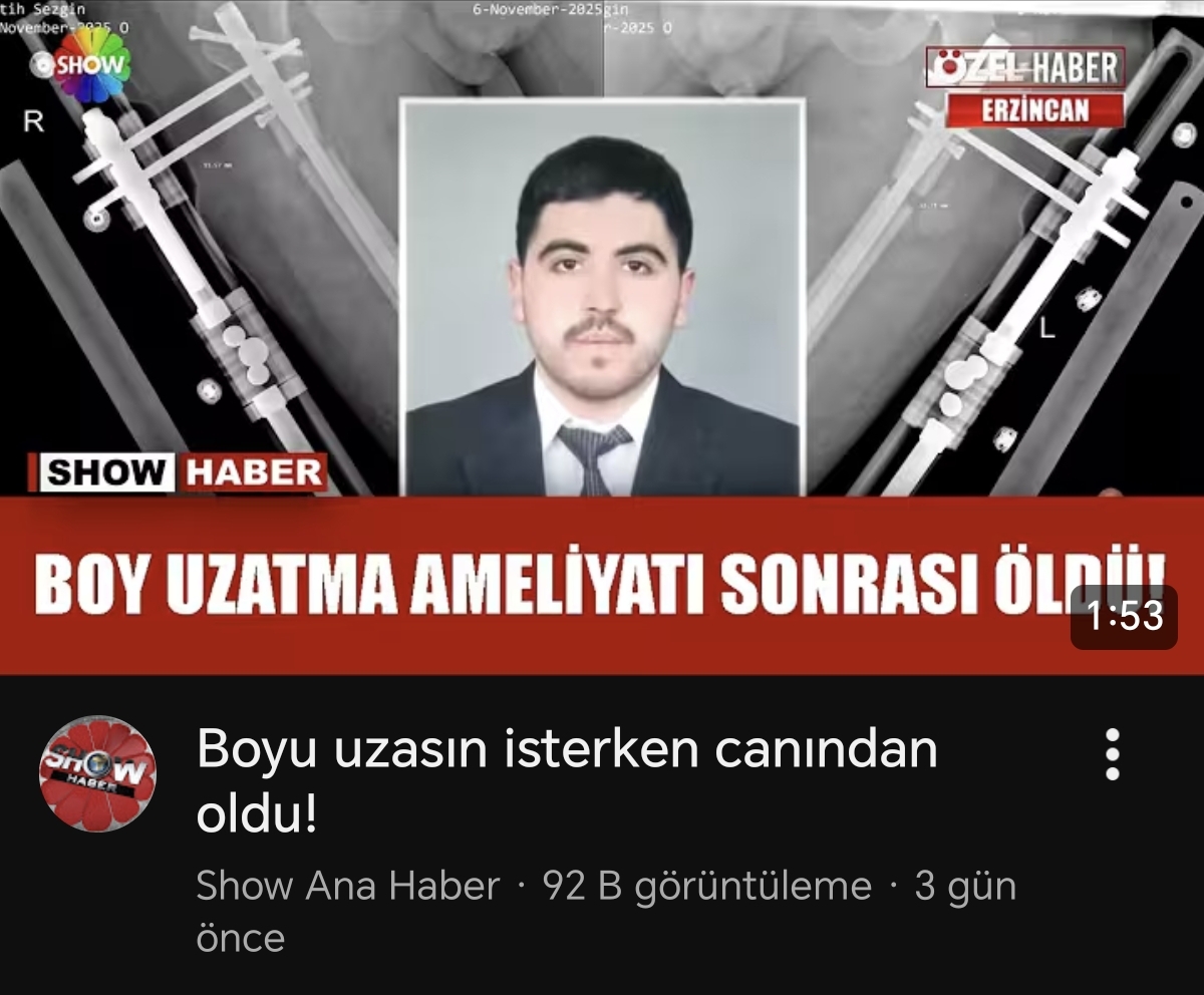 1000063691