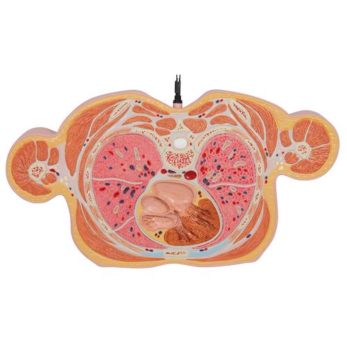 VA20 08 MRI Torso Model with 15 Transverse Sections