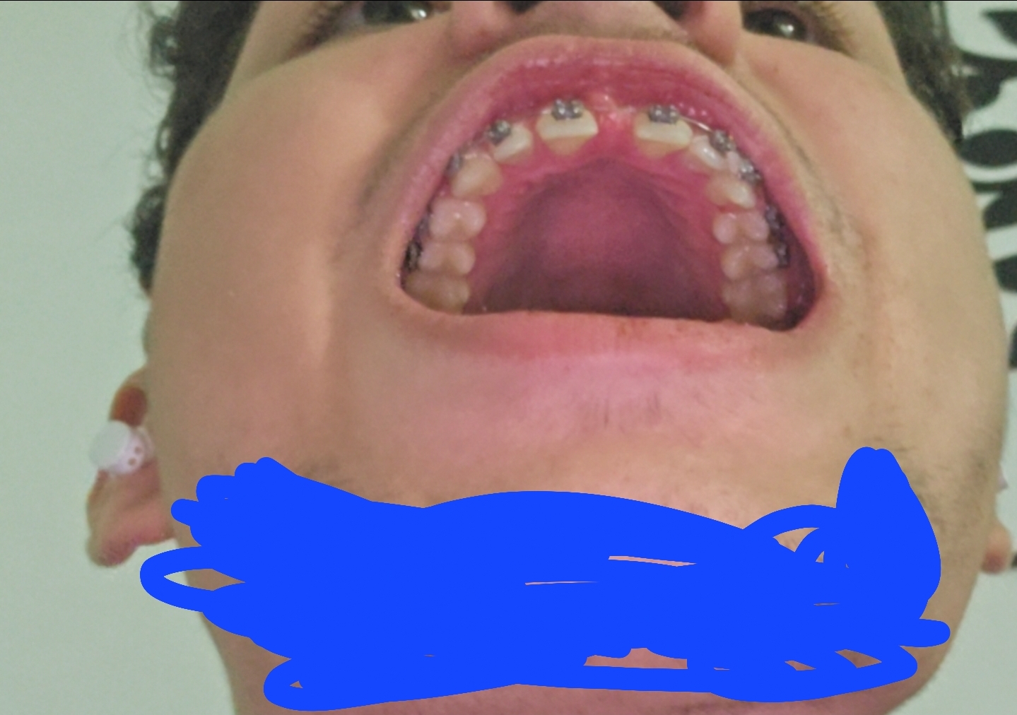 1000299609