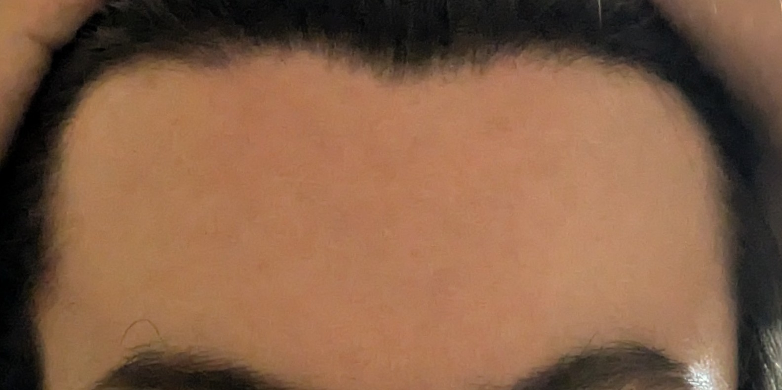 1000020240