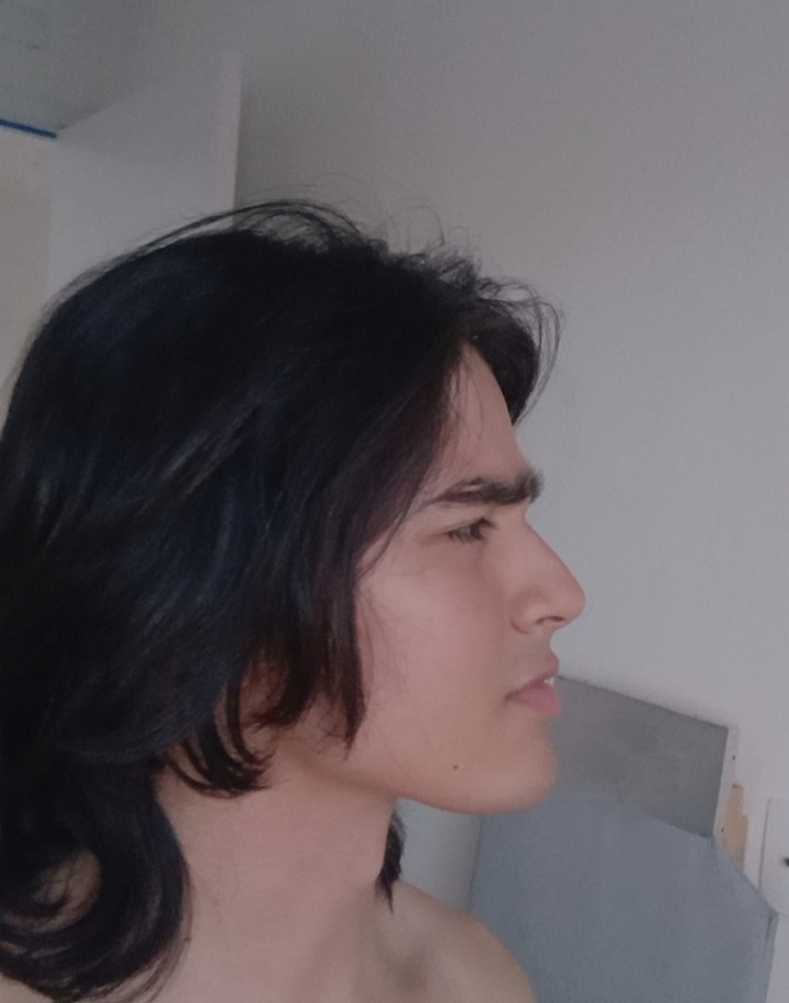 1000235722