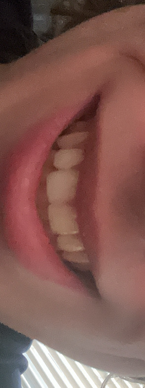 IMG 2323
