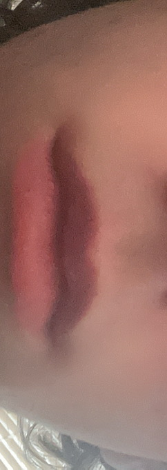 IMG 2324