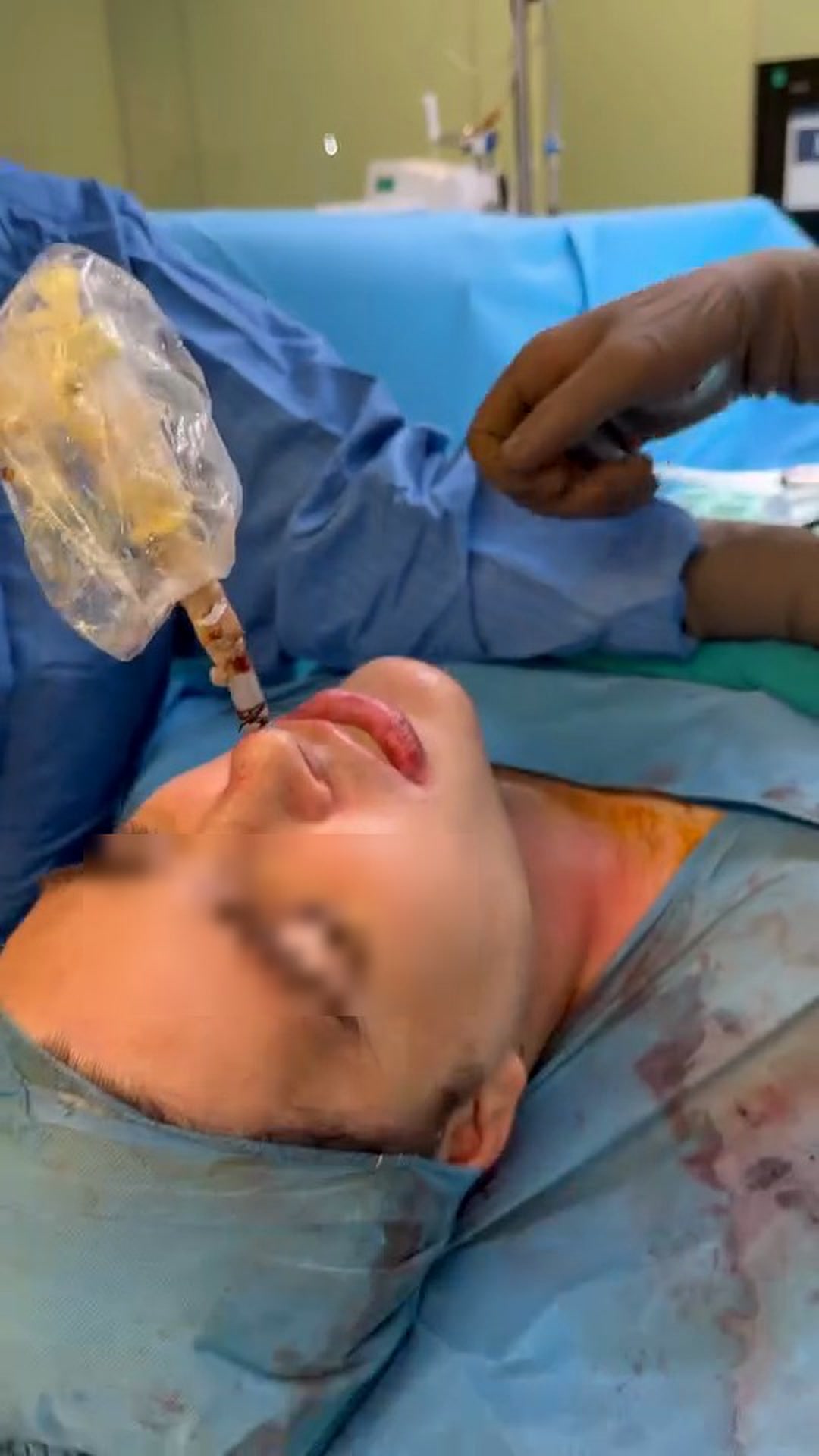 06 or receipt 1 intubated