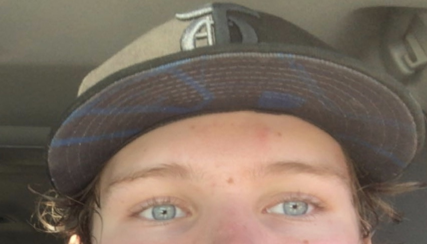 Eyes