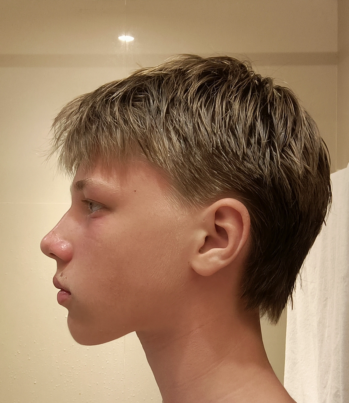 1000016737