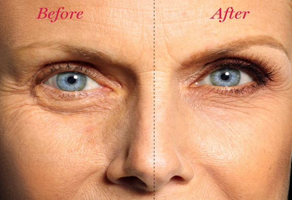 201112 omag undereye bags 1 600x411