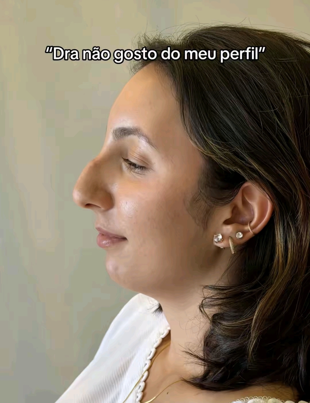 1000054387