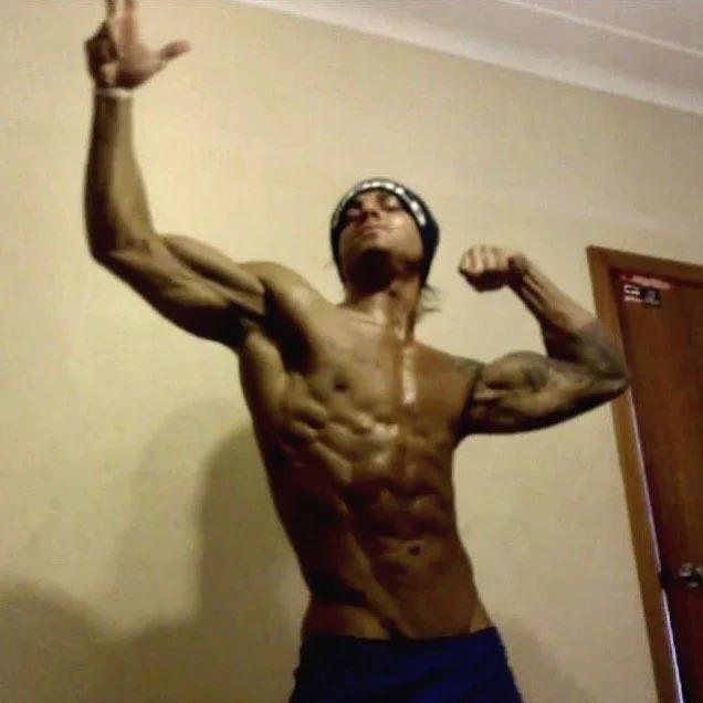 Zyzz