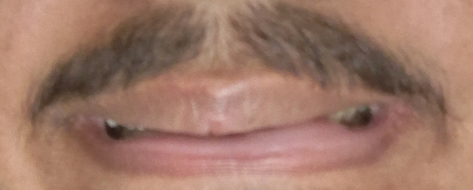 17698