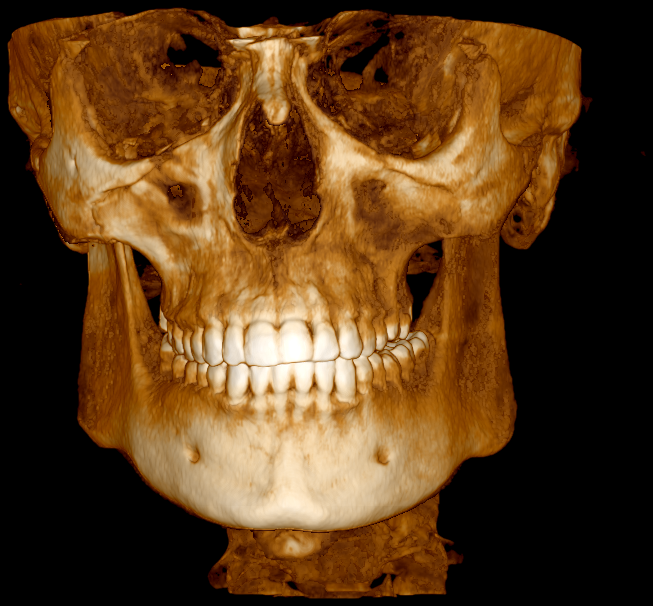 Cbct 1