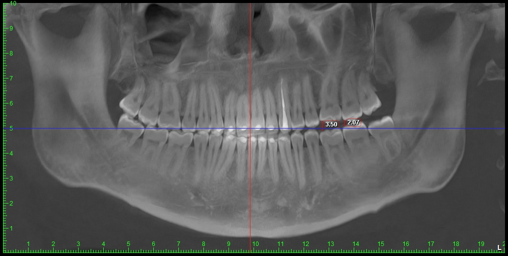 Dental