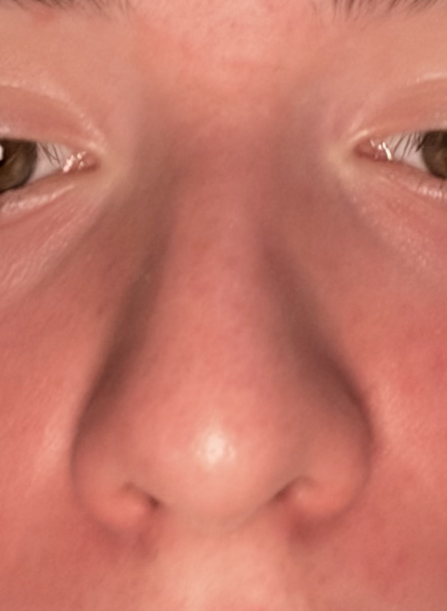 IMG 1339