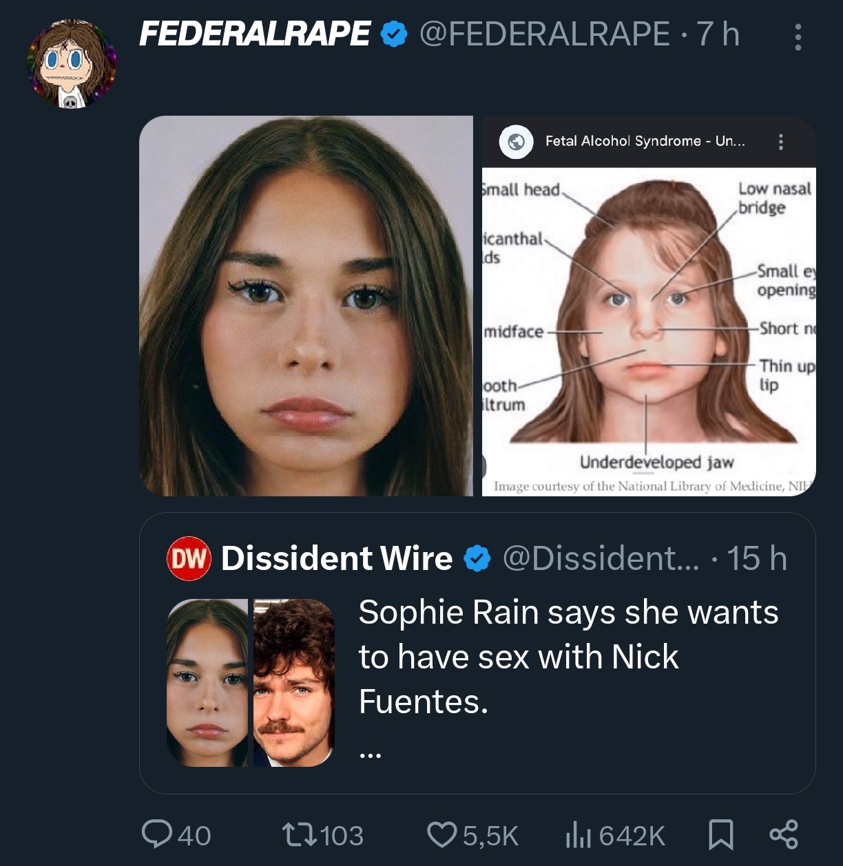 1000011011