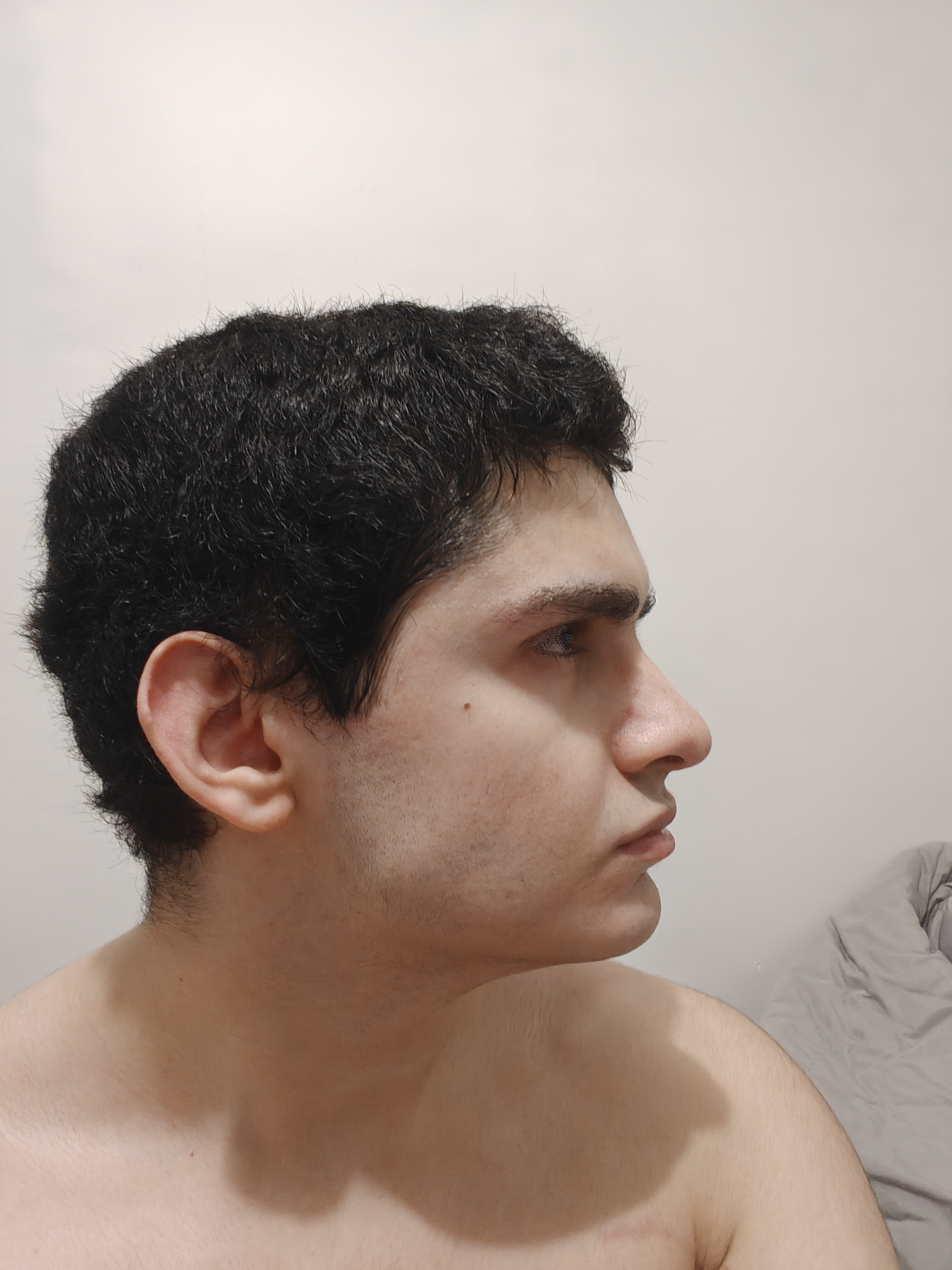 1000008644