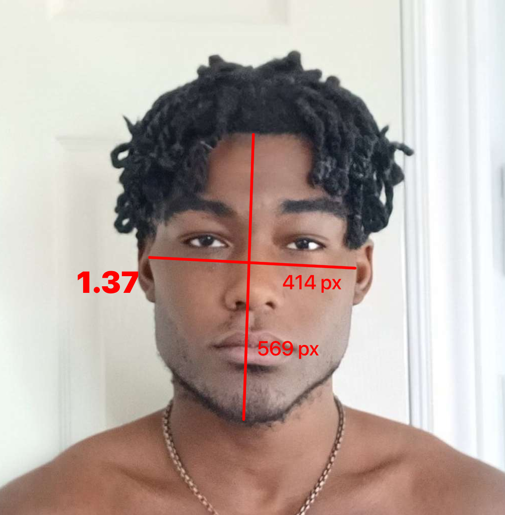 1000100779