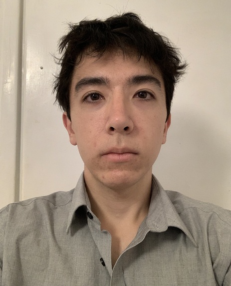 Front view right before surgery