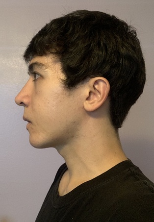 Side view 2 jul 22