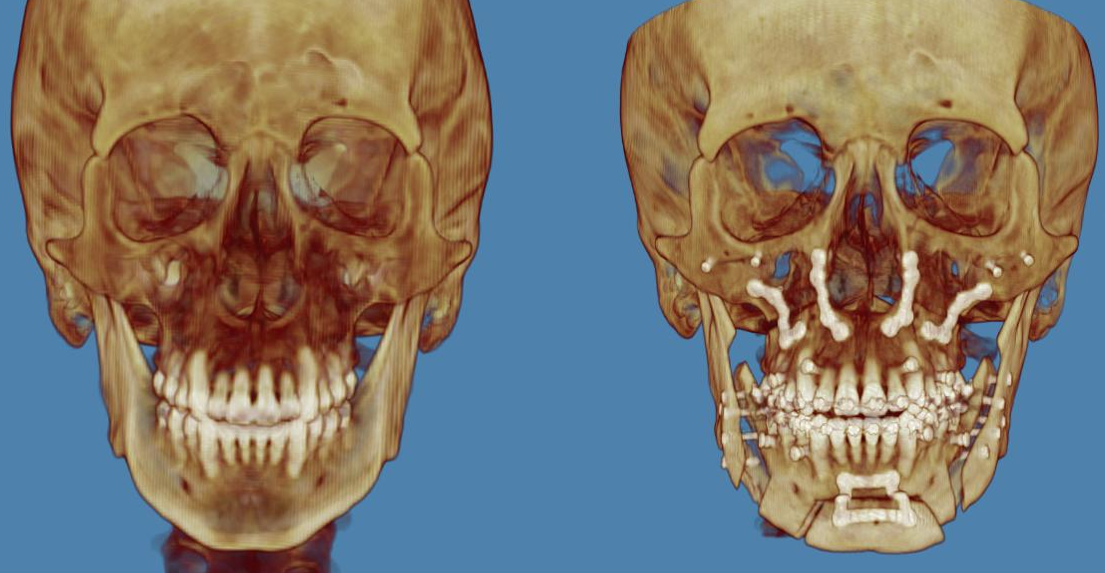 Ct scan compare front view