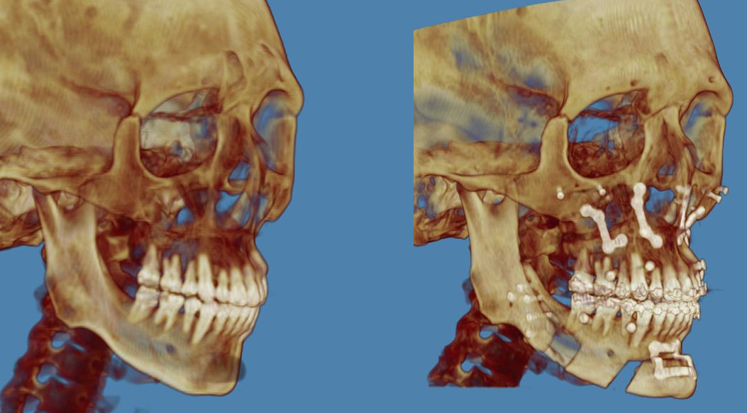 Ct scan compare 45 view