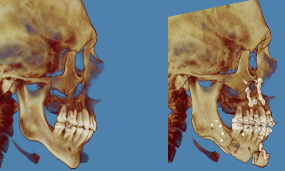 Ct scan compare side view